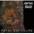 FATAL EXPOSURE