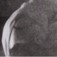 SUNSPOTTED