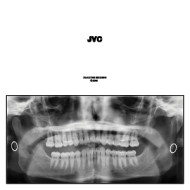 JVC